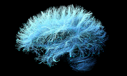 3D Illustration of human brain nerve tracts based on magnetic resonance imaging (MRI) data.